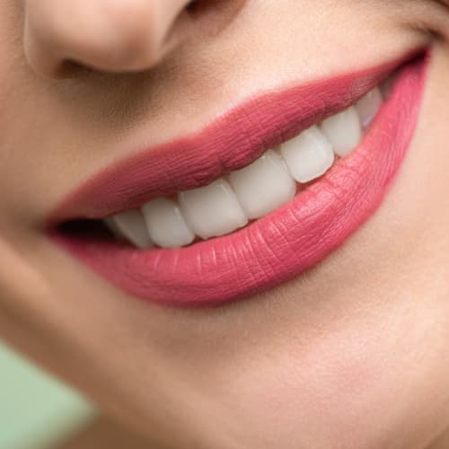 Smile Designing