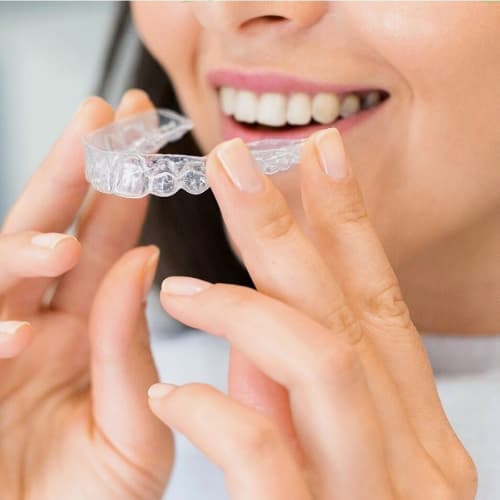 Braces & Aligners